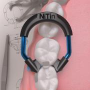 NiTin NT400 Molar Ringer 2stk