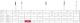 Pussediamanter MDT FG F257-018 Rød 25stk