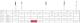 Pussediamanter MDT FG F257-020 Rød 25stk