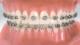 FO 706-0842 BIOQUICK MBT 1 PAS.  018