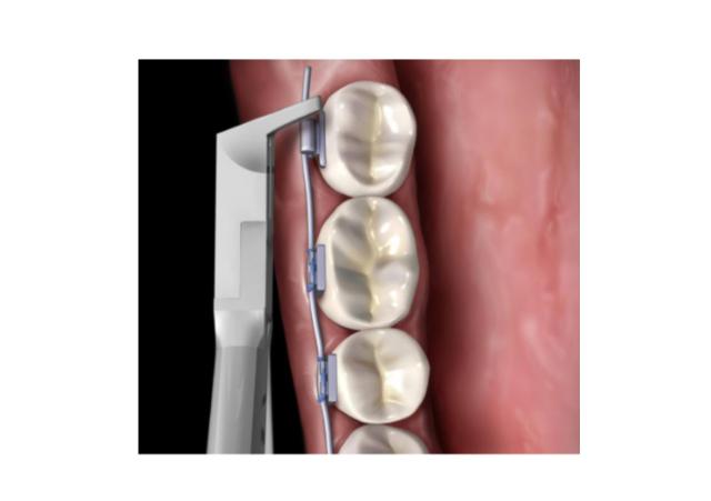 HF 678-113 SLIM FLUSH CUT & DISTAL END CUTTER