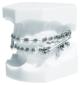 DE 892-000-16 Othodontics Study model Demo/Combi