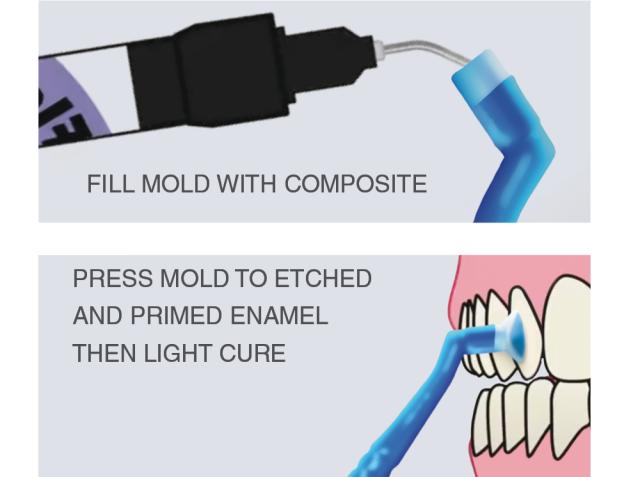 RE RMC Reliamolds Mini-Mold Cuspid Attachm 25stk