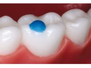 RE RMMP Reliamolds Mini-Mold Mol Pad Attach 25stk
