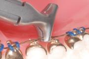 BT IX975 Intra Oral Detailing Plier 0.75mm Step