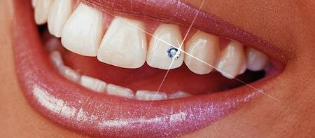 Tannsmykke Diamant Rhinsten liten 1,8mm 5stk